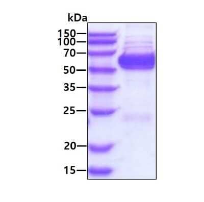 SDS-Page: Recombinant Human GPT2 His Protein [NBP3-18182] - 3ug by SDS-PAGE under reducing condition and visualized by coomassie blue stain